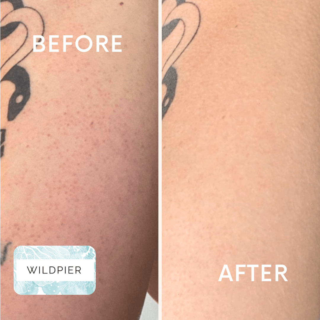 Wildpier™ Plus+ Deep Exfoliating Glove