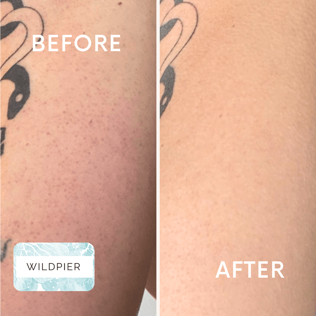 Wildpier™ Ultimate Deep Exfoliating Glove
