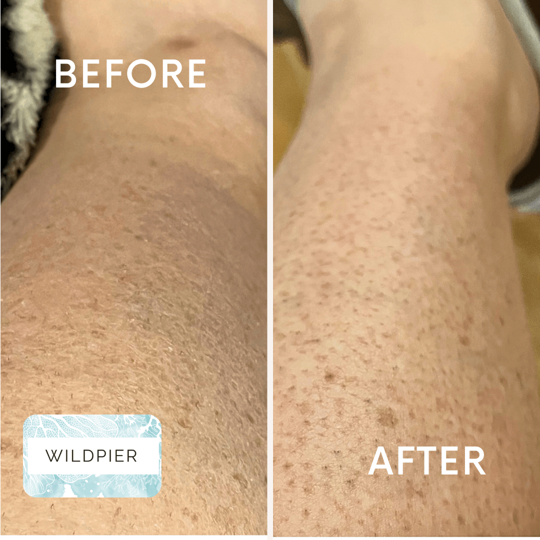 Wildpier™ Plus+ Deep Exfoliating Glove