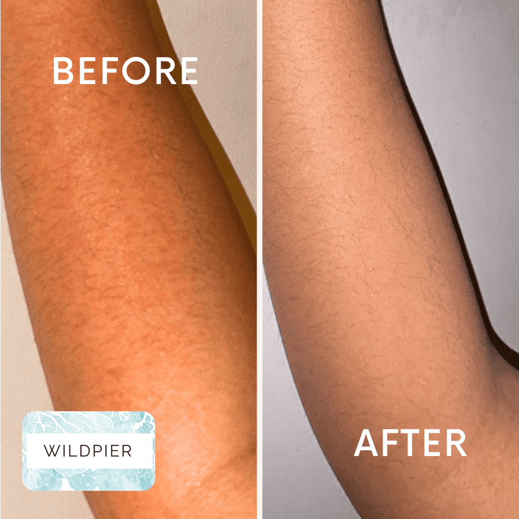 Wildpier™ Deep Exfoliating Glove and Konjac Sponges Bundle