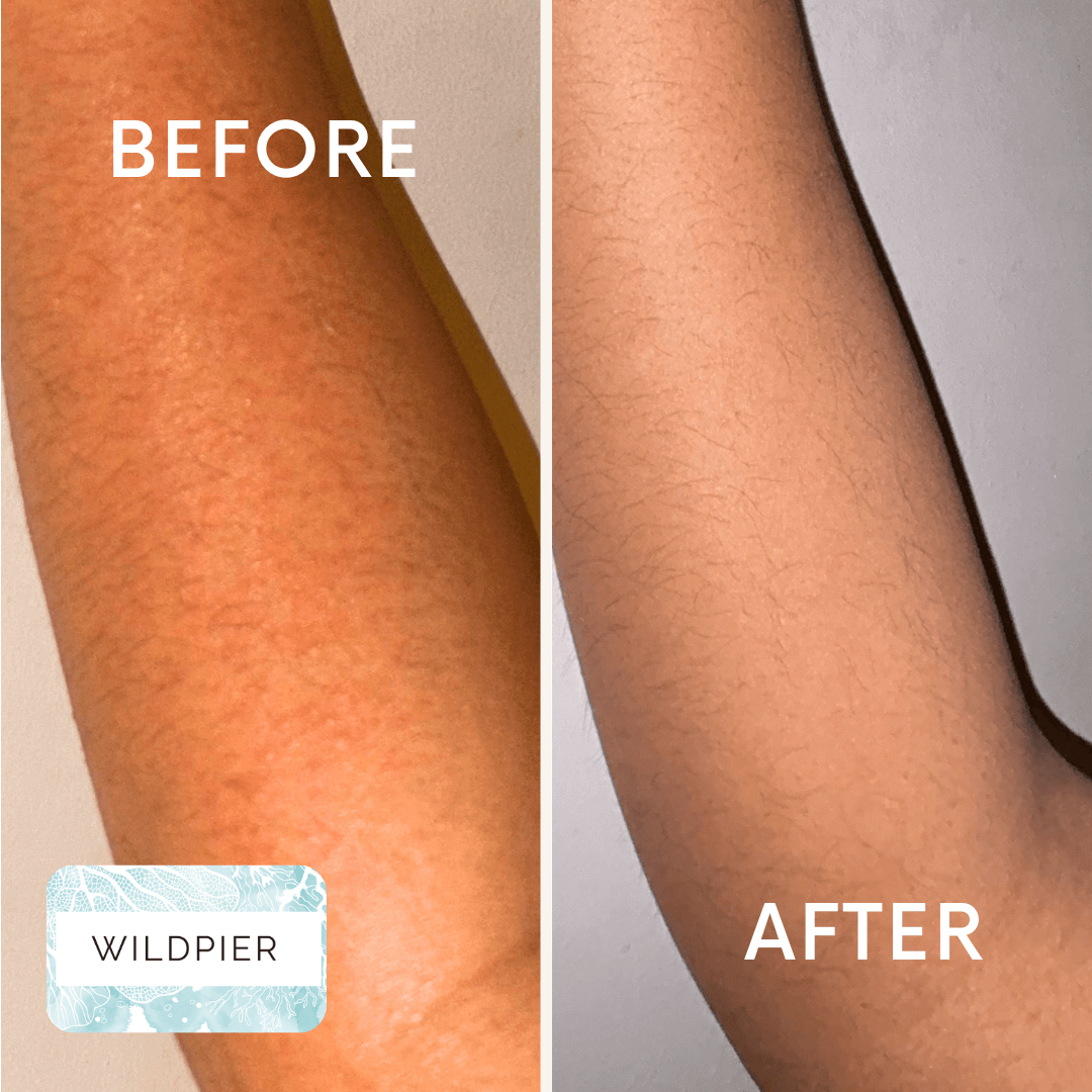 Wildpier™ Deep Exfoliating Glove and Konjac Sponges Bundle