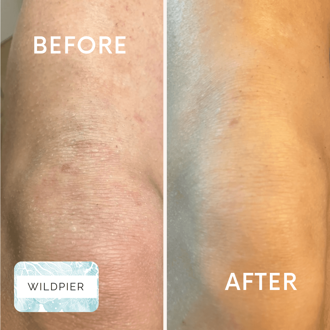 Wildpier™ Ultimate Deep Exfoliating Glove