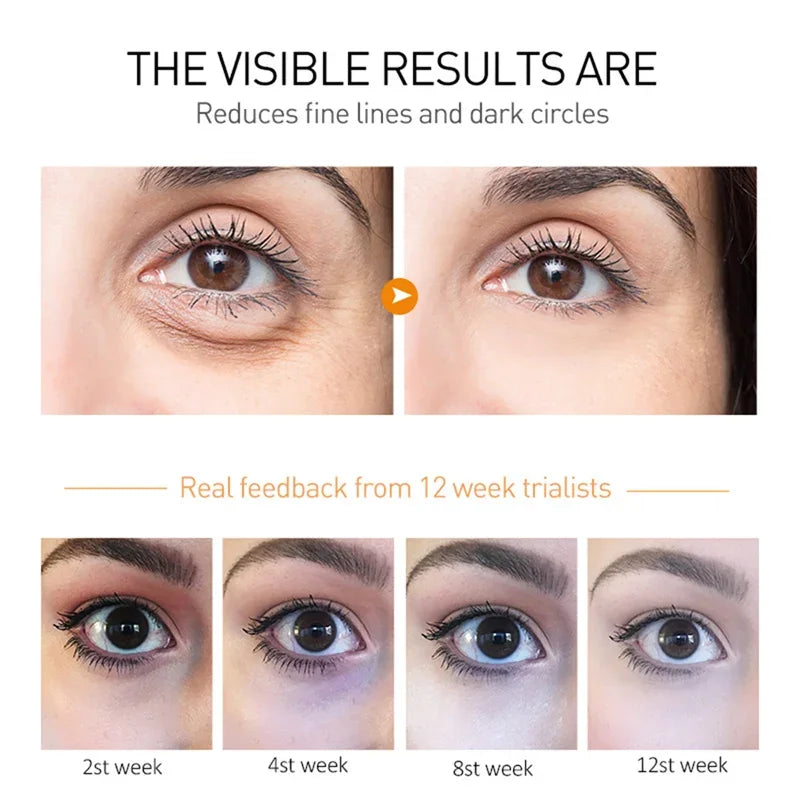 Anti-Wrinkle Avocado Eye Cream
