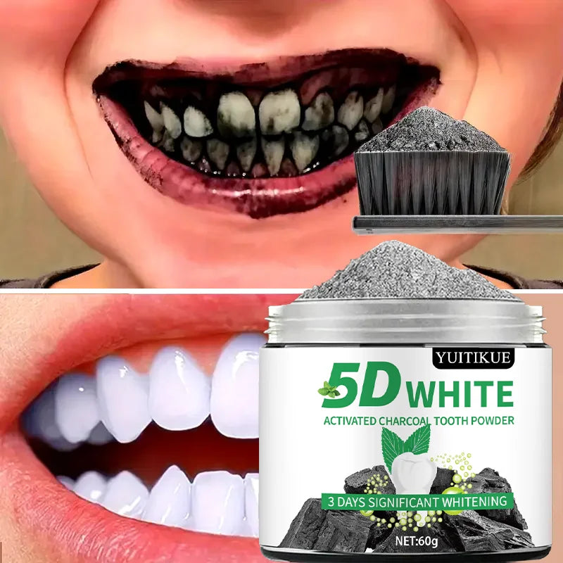 Radiant Smile Whitening Set