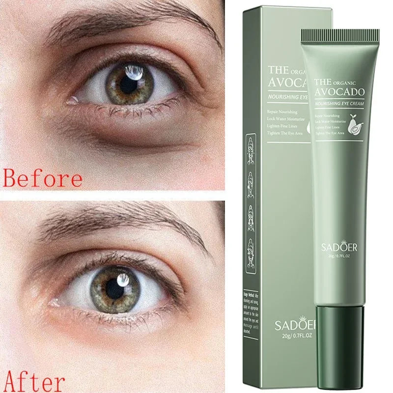 Anti-Wrinkle Avocado Eye Cream
